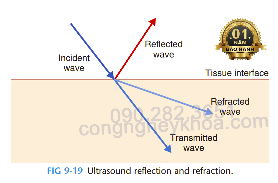 Khi sóng siêu âm đi vào mô sẽ có phản xạ tại bề mặt mô, khúc xạ ra các mô khác, chỉ một phần sóng đi vào vùng điều trị