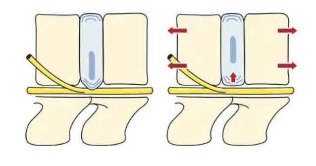 kéo cột sống 