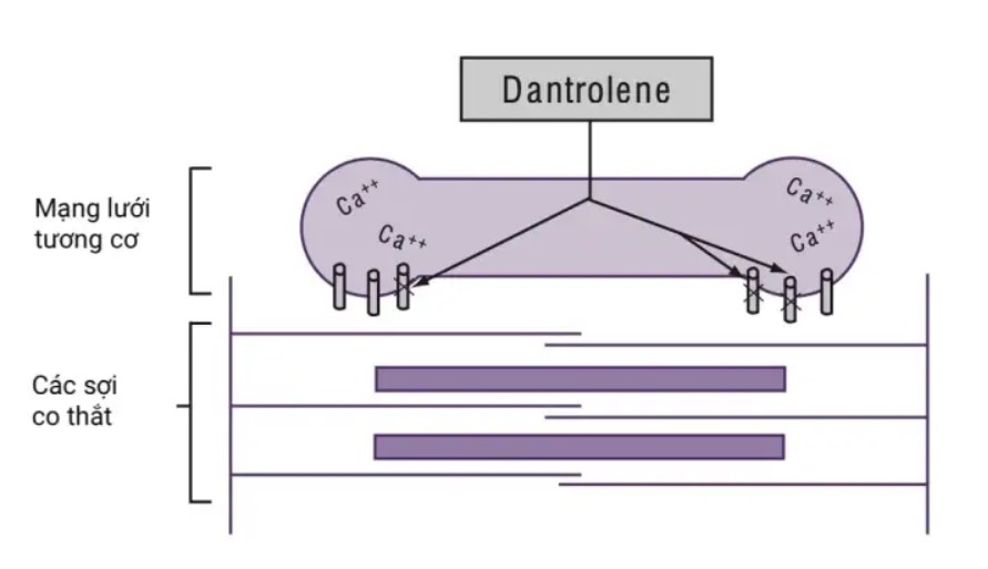 giãn cơ Dantrolence mạng lưới tương cơ, các sợi co thắt