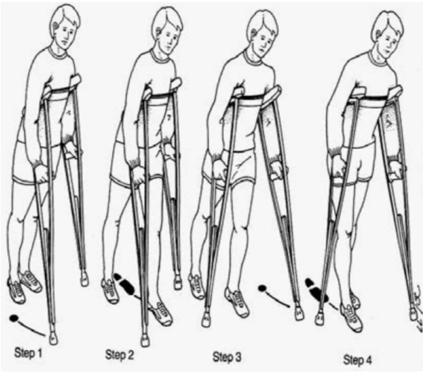 nạng và dáng đi với nạng tập đi từng bước với nạng